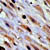 Cells showing presence of Toxoplasma gondii