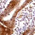 Cells showing presence of Progesterone