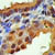 Cells showing presence of Pregnancy Destroying Factor (PDF)