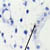 Cells showing presence of Mycobacterium tuberculosis
